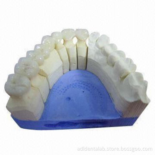 Zirconia Bridge, FDA Approved